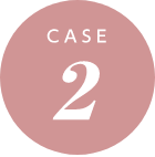 Case2